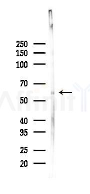LBR Antibody - Western blot analysis of lysates from Rat testis, using LBR Antibody at 1/1000 dilution.
