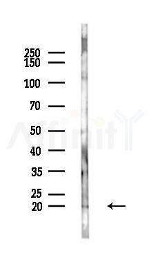 UBE2C Antibody - Western blot analysis of lysates from Mouse lung, using UBE2C Antibody at 1/1000 dilution.