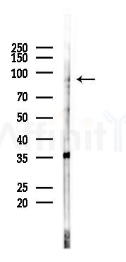 CDC5L Antibody - Western blot analysis of lysates from COLO205 cells(starvation 24h treatment), using CDC5L Antibody at 1/1000 dilution.