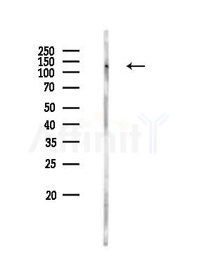 NLRP3 Antibody - Western blot analysis of lysates from PC12 cells(UV 30min treatment), using NLRP3 Antibody at 1/1000 dilution.