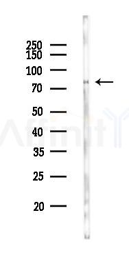 NLRP3 Antibody - Western blot analysis of lysates from Rat heart, using NLRP3 Antibody at 1/1000 dilution.