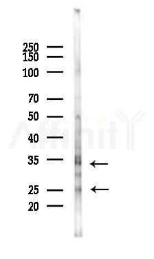 PSMB4 Antibody - Western blot analysis of lysates from K562 cells(heat-shock 45min treatment), using PSMB4 Antibody at 1/1000 dilution.