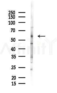 Occludin Antibody - Western blot analysis of lysates from 293 cells(heat-shock 45min treatment), using Occludin Antibody at 1/1000 dilution.
