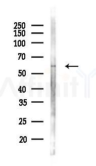 Occludin Antibody - Western blot analysis of lysates from HUVEC cells(starvation 24h treatment), using Occludin Antibody at 1/1000 dilution.