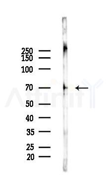 CD68 Antibody - Western blot analysis of lysates from A2780 cells(LPS 4h treatment), using CD68 Antibody at 1/1000 dilution.