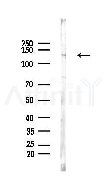 CD68 Antibody - Western blot analysis of lysates from COLO205 cells(UV 30min treatment), using CD68 Antibody at 1/1000 dilution.