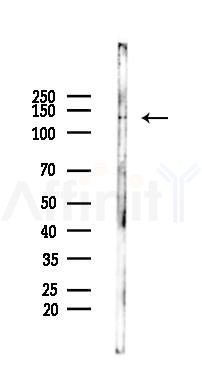 CD68 Antibody - Western blot analysis of lysates from K562 cells(heat-shock 45min treatment), using CD68 Antibody at 1/1000 dilution.