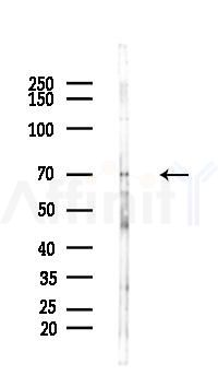 CD68 Antibody - Western blot analysis of lysates from HUVEC cells(starvation 24h treatment), using CD68 Antibody at 1/1000 dilution.
