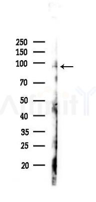 Phospho-Nrf2 (Ser40) Antibody - Western blot analysis of lysates from PC12 cells(UV 30min treatment), using Phospho-Nrf2 (Ser40) Antibody at 1/1000 dilution.