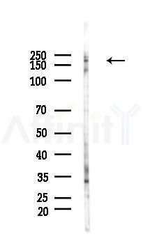 Rictor Antibody - Western blot analysis of lysates from COLO205 cells(heat-shock 45min treatment), using Rictor Antibody at 1/1000 dilution.