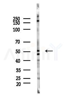 Phospho-IRAK4 (Thr345/Ser346) Antibody - Western blot analysis of lysates from COLO205 cells(heat-shock 45min treatment), using Phospho-IRAK4 (Thr345/Ser346) Antibody at 1/1000 dilution.