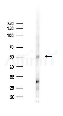 Wnt10a Antibody - Western blot analysis of lysates from Hela cells(UV 30min treatment), using Wnt10a Antibody at 1/1000 dilution.