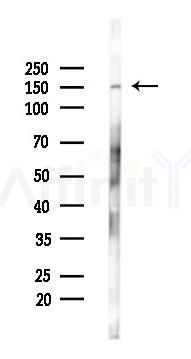 Phospho-PERK (Thr982) Antibody - Western blot analysis of lysates from Hela cells(starvation 24h treatment), using Phospho-PERK (Thr982) Antibody at 1/1000 dilution.