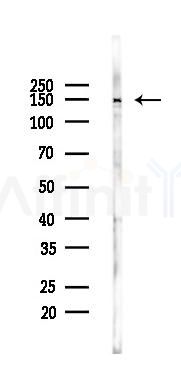 Phospho-PERK (Thr982) Antibody - Western blot analysis of lysates from PC12 cells(UV 30min treatment), using Phospho-PERK (Thr982) Antibody at 1/1000 dilution.
