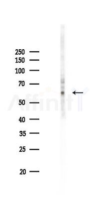 STXBP4 Antibody - Western blot analysis of lysates from K562 cells(starvation 24h treatment), using STXBP4 Antibody at 1/1000 dilution.