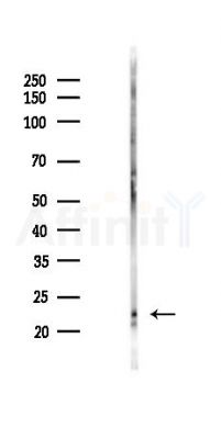NRAS Antibody - Western blot analysis of lysates from Rat testis, using NRAS Antibody at 1/1000 dilution.