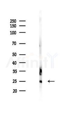 RHOQ Antibody - Western blot analysis of lysates from Rat testis, using RHOQ Antibody at 1/1000 dilution.