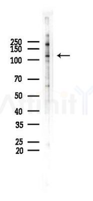 IRE1 Antibody - Western blot analysis of lysates from 293 cells(heat-shock 45min treatment), using IRE1 Antibody at 1/1000 dilution.