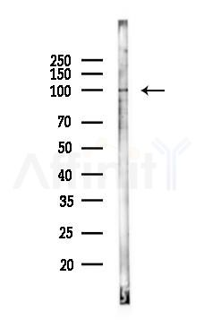 SMURF1 Antibody - Western blot analysis of lysates from 293 cells(heat-shock 45min treatment), using SMURF1 Antibody at 1/1000 dilution.