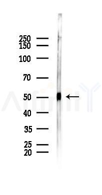 PINK1 Antibody - Western blot analysis of lysates from Rat kidney, using PINK1 Antibody at 1/1000 dilution.