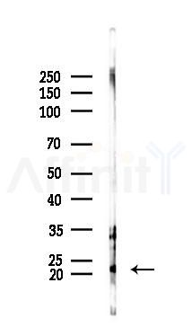 MYL12A Antibody - Western blot analysis of lysates from PC12 cells(UV 30min treatment), using MYL12A Antibody at 1/1000 dilution.
