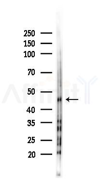 PKA-R2 beta Antibody - Western blot analysis of lysates from K562 cells(UV 30min treatment), using PKA-R2 beta Antibody at 1/1000 dilution.