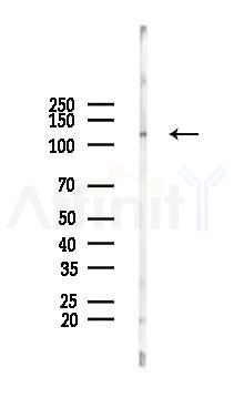 REST Antibody - Western blot analysis of lysates from Rat lung, using REST Antibody at 1/1000 dilution.