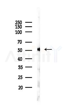 beta Tubulin Antibody - Western blot analysis of lysates from 293 cells(heat-shock 45min treatment), using beta Tubulin Antibody at 1/1000 dilution.