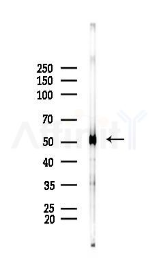 beta Tubulin Antibody - Western blot analysis of lysates from PC12 cells(UV 30min treatment), using beta Tubulin Antibody at 1/1000 dilution.