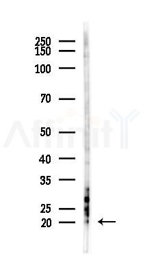 PDCD6 Antibody - Western blot analysis of lysates from HUVEC cells(UV 30min treatment), using PDCD6 Antibody at 1/1000 dilution.