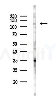 ICAM3 Antibody - Western blot analysis of lysates from 293 cells(heat-shock 45min treatment), using ICAM3 Antibody at 1/1000 dilution.