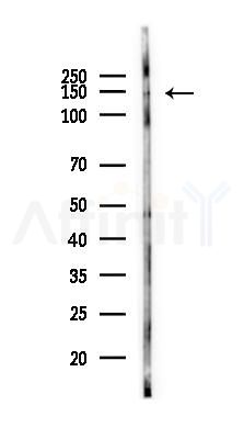 Ras-GRF1 Antibody - Western blot analysis of lysates from Rat heart, using Ras-GRF1 Antibody at 1/1000 dilution.
