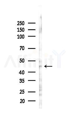 ING3 Antibody - Western blot analysis of lysates from K562 cells(UV 30min treatment), using ING3 Antibody at 1/1000 dilution.