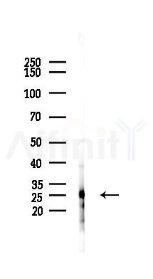 CD3G Antibody - Western blot analysis of lysates from HUVEC cells(LPS 4h treatment), using CD3G Antibody at 1/1000 dilution.