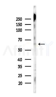 Myt1 Antibody - Western blot analysis of lysates from Rat heart, using Myt1 Antibody at 1/1000 dilution.