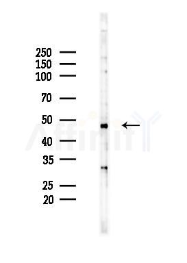 FDFT1 Antibody - Western blot analysis of lysates from HUVEC cells(starvation 24h treatment), using FDFT1 Antibody at 1/1000 dilution.