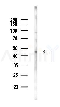 FNTA Antibody - Western blot analysis of lysates from 293 cells(heat-shock 45min treatment), using FNTA Antibody at 1/1000 dilution.
