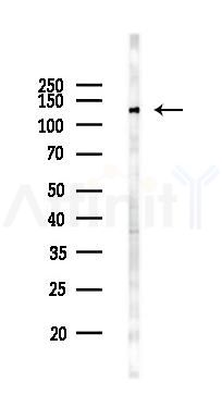 CDH4 Antibody - Western blot analysis of lysates from 293 cells(heat-shock 45min treatment), using CDH4 Antibody at 1/1000 dilution.