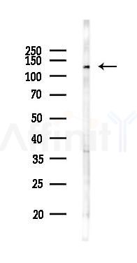 CDH4 Antibody - Western blot analysis of lysates from HUVEC cells(UV 30min treatment), using CDH4 Antibody at 1/1000 dilution.