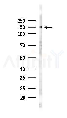 CDH4 Antibody - Western blot analysis of lysates from K562 cells(UV 30min treatment), using CDH4 Antibody at 1/1000 dilution.