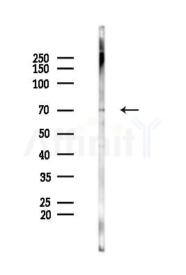 TRIM69 Antibody - Western blot analysis of lysates from PC12 cells(UV 30min treatment), using TRIM69 Antibody at 1/1000 dilution.