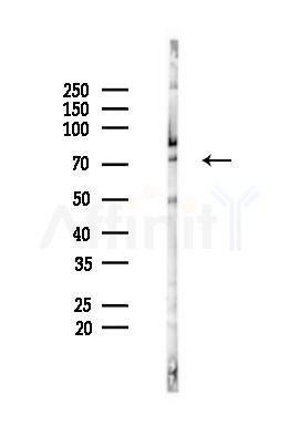 TRIM69 Antibody - Western blot analysis of lysates from HUVEC cells(starvation 24h treatment), using TRIM69 Antibody at 1/1000 dilution.