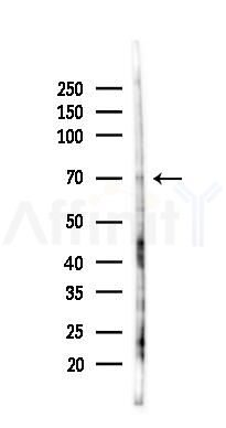 ZBTB33 Antibody - Western blot analysis of lysates from K562 cells(UV 30min treatment), using ZBTB33 Antibody at 1/1000 dilution.
