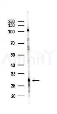 TAF9B Antibody - Western blot analysis of lysates from Hela cells(heat-shock 45min treatment), using TAF9B Antibody at 1/1000 dilution.
