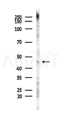 TRAM2 Antibody - Western blot analysis of lysates from HUVEC cells(UV 30min treatment), using TRAM2 Antibody at 1/1000 dilution.