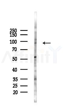 CDH10 Antibody - Western blot analysis of lysates from COLO205 cells(starvation 24h treatment), using CDH10 Antibody at 1/1000 dilution.