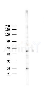 CDX4 Antibody - Western blot analysis of lysates from A2780 cells(starvation 24h treatment), using CDX4 Antibody at 1/1000 dilution.
