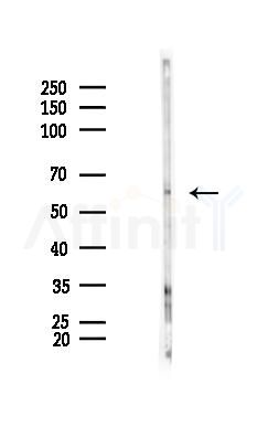 KRT12 Antibody - Western blot analysis of lysates from Hela cells(starvation 24h treatment), using KRT12 Antibody at 1/1000 dilution.