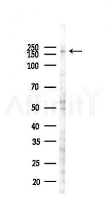ZFYVE9 Antibody - Western blot analysis of lysates from Hela cells(heat-shock 45min treatment), using ZFYVE9 Antibody at 1/1000 dilution.