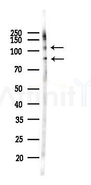 CD93 Antibody - Western blot analysis of lysates from 293 cells(heat-shock 45min treatment), using CD93 Antibody at 1/1000 dilution.